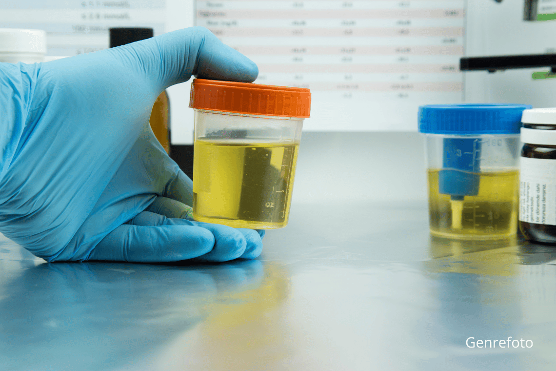 Politiet: Ingen tegn på drugging ved sommerens ringridninger