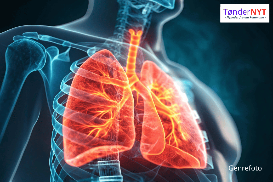 2.343 borgere i Tønder går rundt med dødelig lungesygdom uden at vide det: Gratis lunge-tjek den 22. november